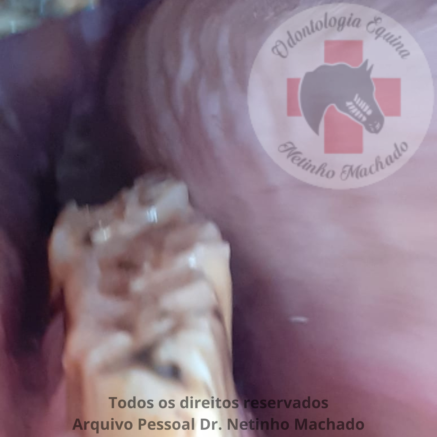 Degrau dentário (2).png