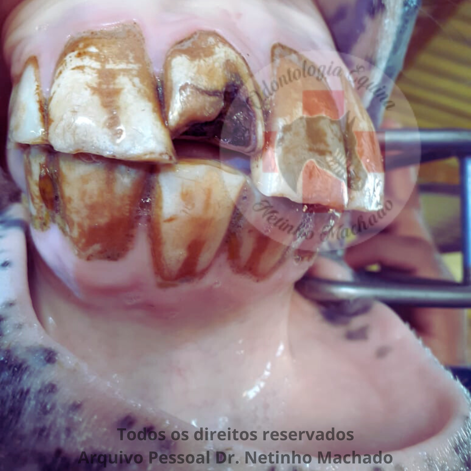 Sem nome (1500 x 1501 px) (23).png