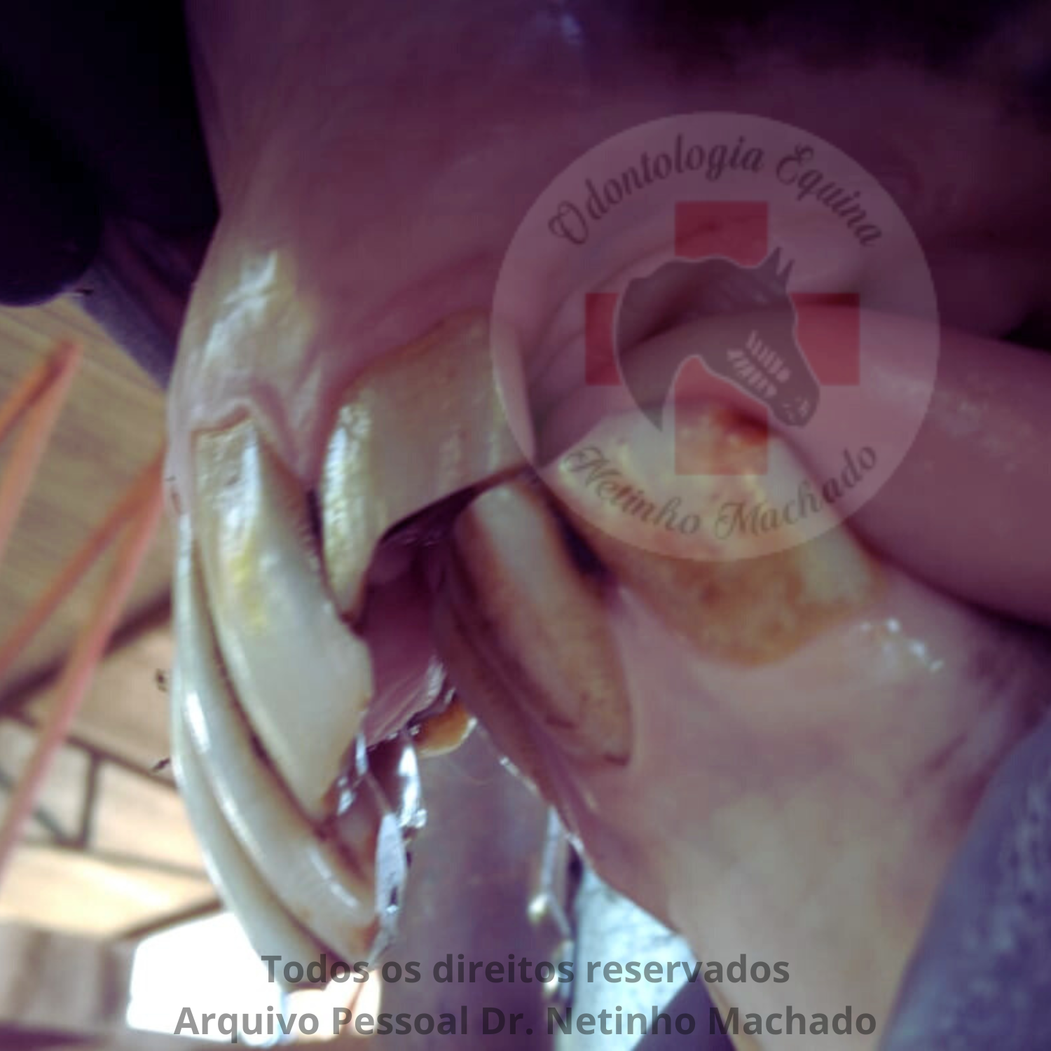 Sem nome (1500 x 1501 px) (7).png