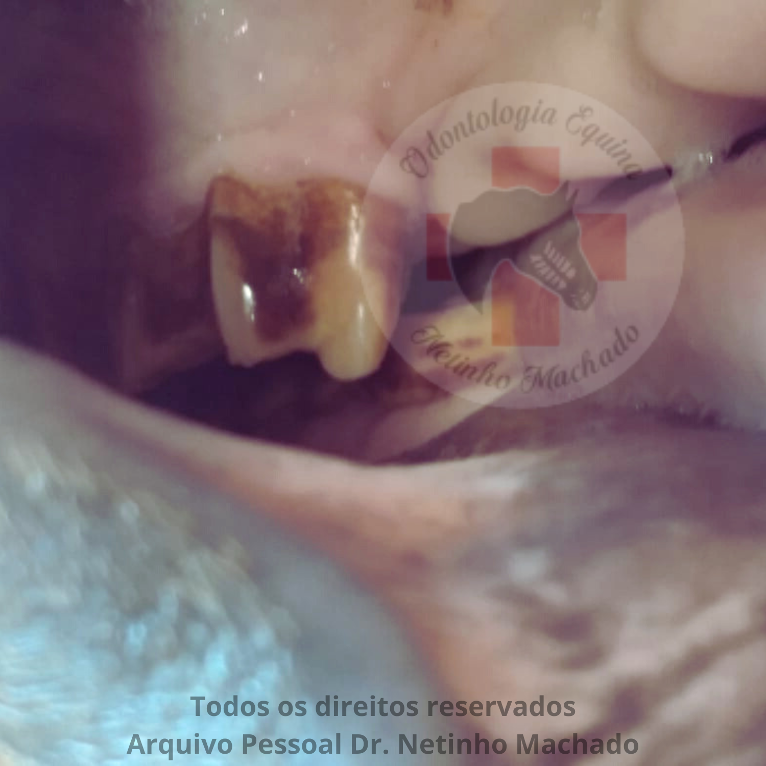 Sem nome (1500 x 1501 px) (8).png