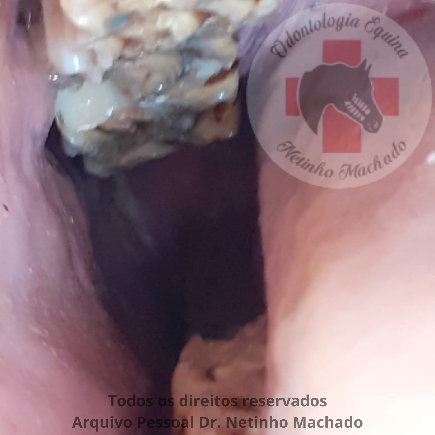 Degrau dentário (1).png