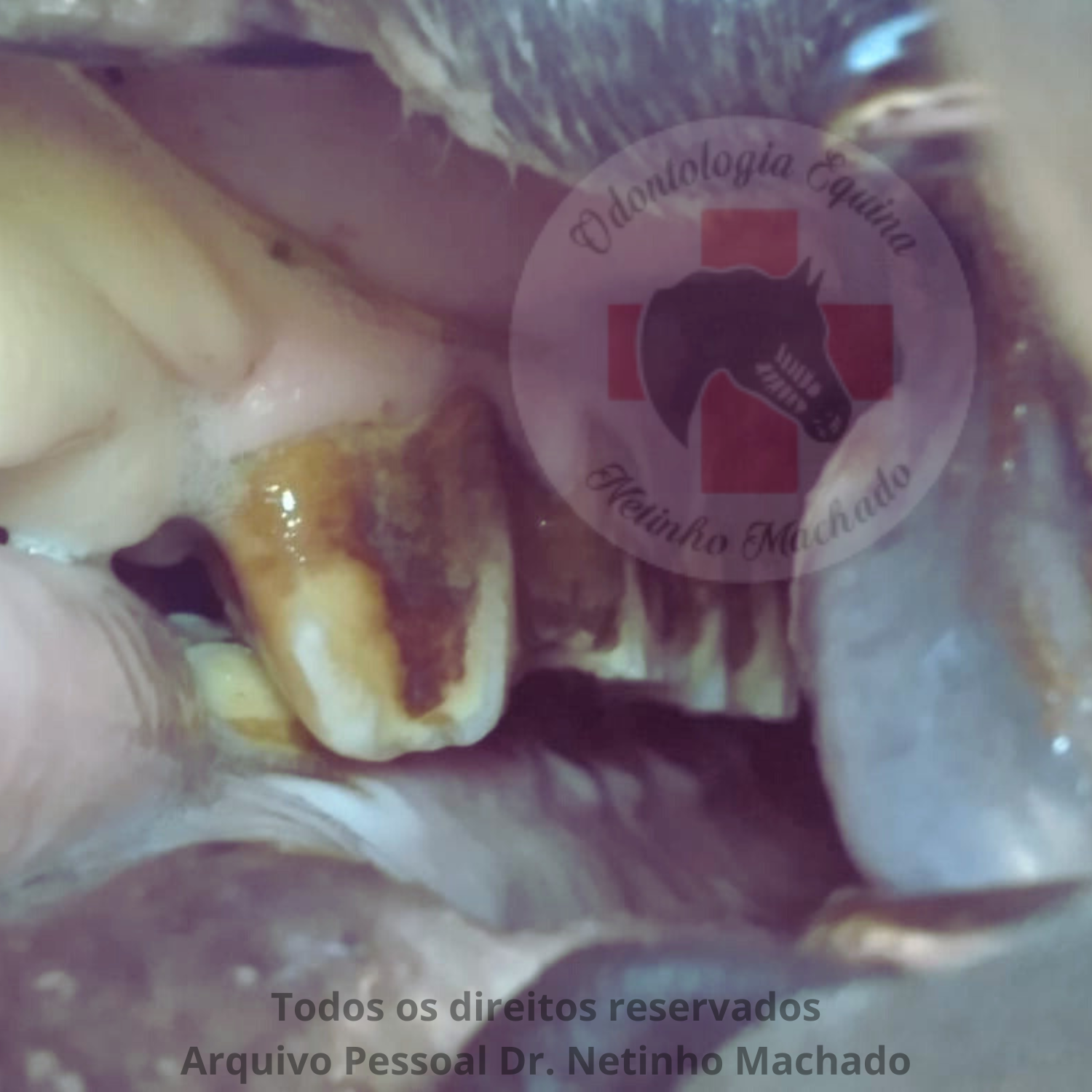 Sem nome (1500 x 1501 px) (9).png